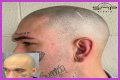 Unveiling The Truth: Steve Austin's Baldness Decoded